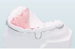 ラップアラウンドリテーナー