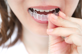 マウスピース型矯正装置