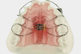 拡大床（ネジタイプ）