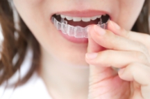 マウスピース型矯正装置（インビザライン ※）