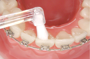 ペンタイプ 歯ブラシ