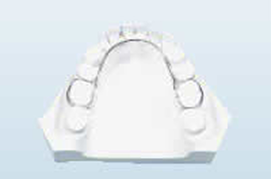 リンガルアーチ